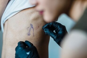 Remoção de tatuagem a laser em São Paulo: guia técnico completo Remoção de tatuagem a laser em São Paulo: guia técnico completo