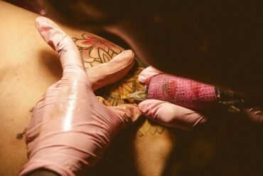 Preço da remoção de tatuagem a laser: guia passo a passo Preço da remoção de tatuagem a laser: guia passo a passo
